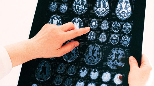 ADHD Without Stimulants: How Healing Your Gut Unlocks Natural Focus