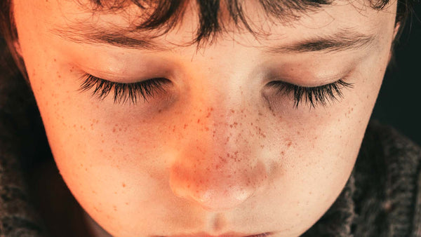 Autism and Eczema - The Hidden Gut-Brain Trigger