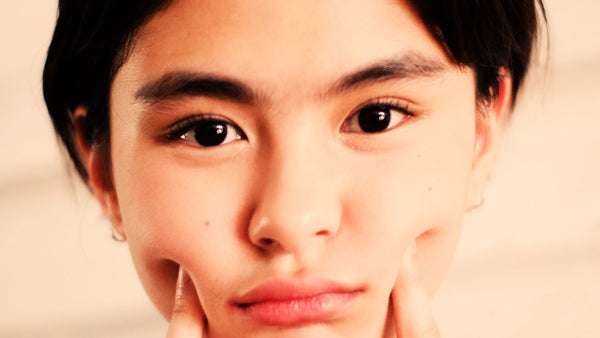 How to Heal Acne Naturally by Improving Your Gut Microbiome