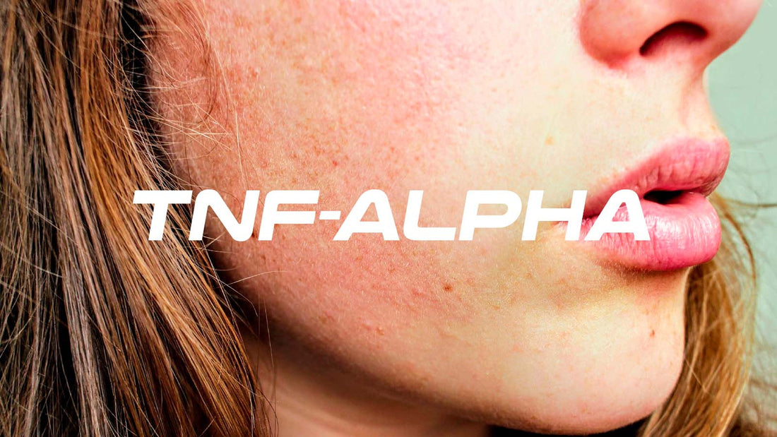 Lower TNF-Alpha Naturally - The Key to Psoriasis Relief